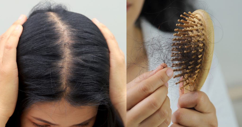 ブラッシング時の抜け毛の様子50代女性の分け目が目立つ状態。